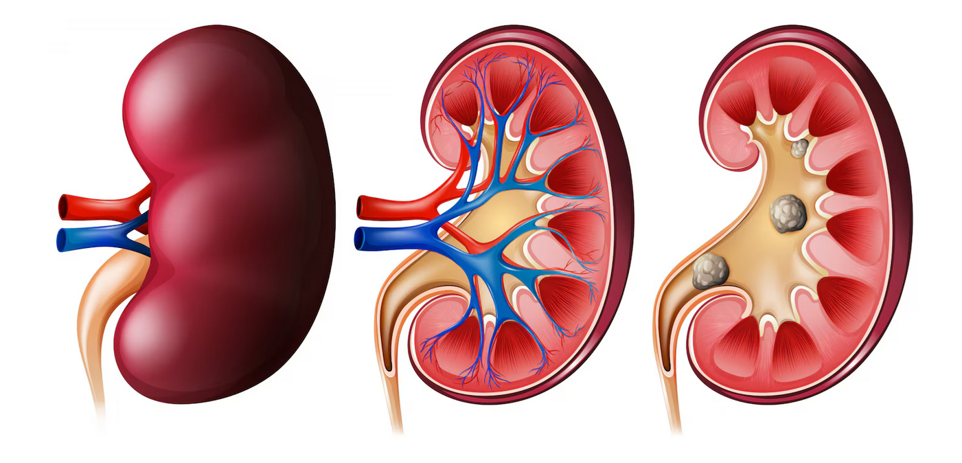 renal